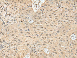 ATXN3 Polyclonal Antibody Reactivity Human
