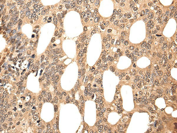 ATF7 Polyclonal Antibody Reactivity Human