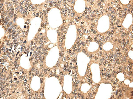 ATF7 Polyclonal Antibody Reactivity Human