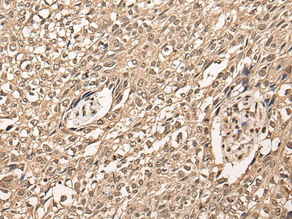 ATF7 Polyclonal Antibody Reactivity Human