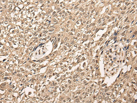 ATF7 Polyclonal Antibody Reactivity Human