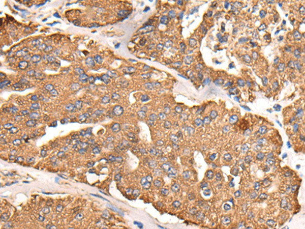 ATP5C1 Polyclonal Antibody Reactivity Human