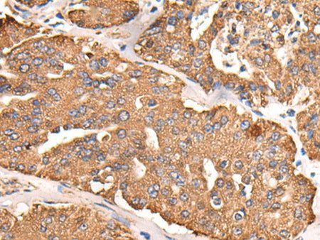 ATP5C1 Polyclonal Antibody Reactivity Human