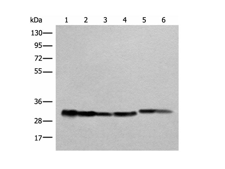 ATP5C1 Polyclonal Antibody Reactivity Human