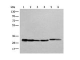 ATP5C1 Polyclonal Antibody Reactivity Human