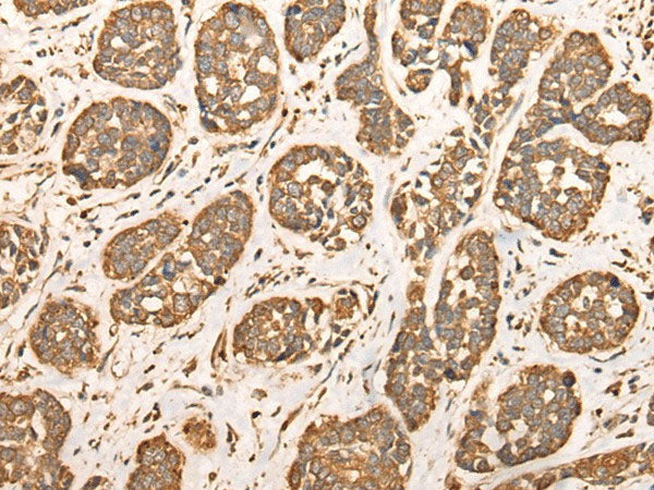 BAIAP2L1 Polyclonal Antibody Reactivity Human