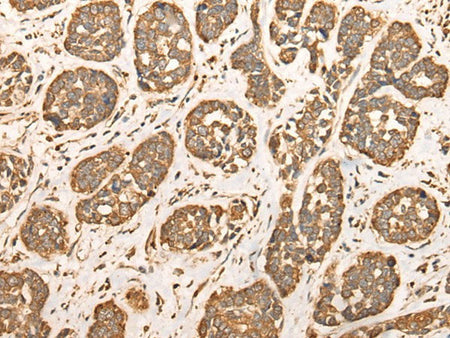 BAIAP2L1 Polyclonal Antibody Reactivity Human