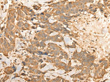 BAIAP2L1 Polyclonal Antibody Reactivity Human