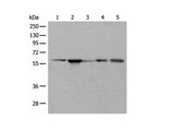 BAIAP2L1 Polyclonal Antibody Reactivity Human