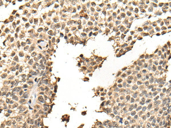 BATF Polyclonal Antibody Reactivity Human