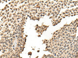 BATF Polyclonal Antibody Reactivity Human