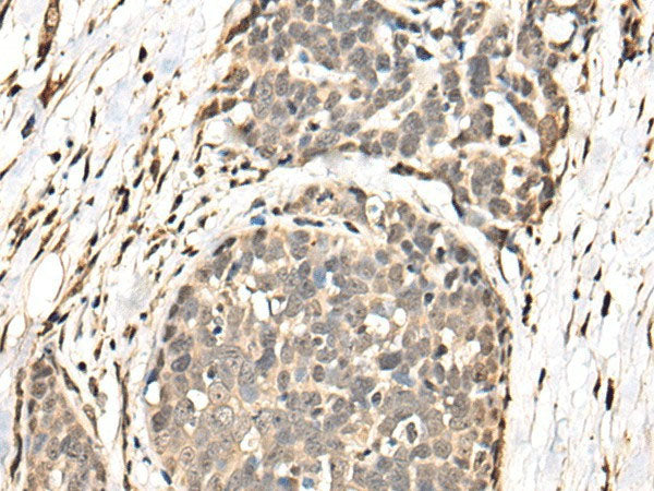 BATF Polyclonal Antibody Reactivity Human