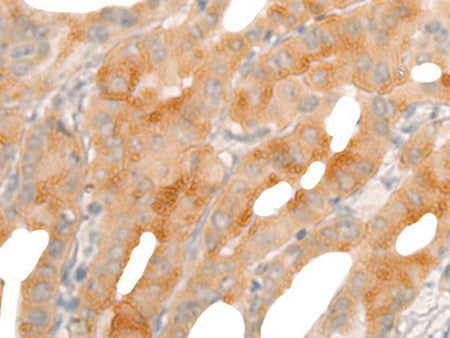 BBOX1 Polyclonal Antibody Reactivity Human
