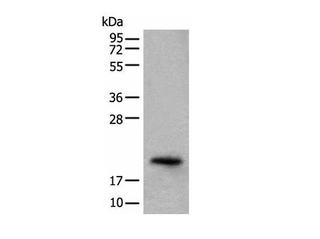 CRYGS Polyclonal Antibody Reactivity Human