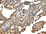PHF21A Polyclonal Antibody Reactivity Mouse