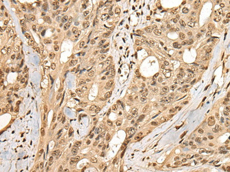 PHF21A Polyclonal Antibody Reactivity Mouse