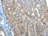BHMT2 Polyclonal Antibody Reactivity Human