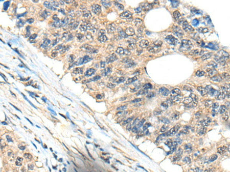 BHMT2 Polyclonal Antibody Reactivity Human