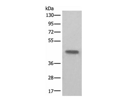 BHMT2 Polyclonal Antibody Reactivity Human