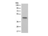 BHMT2 Polyclonal Antibody Reactivity Human