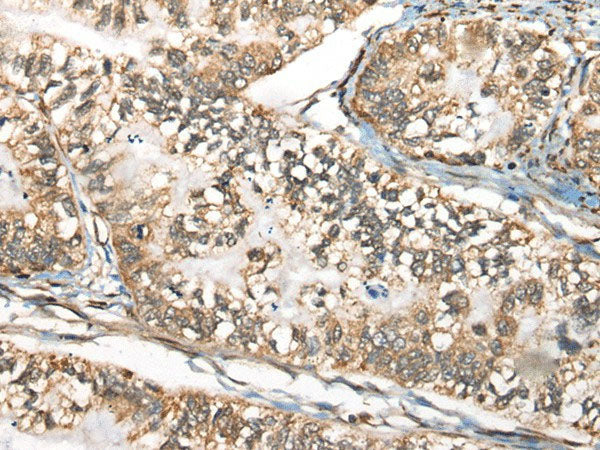 BLNK Polyclonal Antibody Reactivity Human