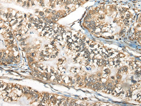 BLNK Polyclonal Antibody Reactivity Human