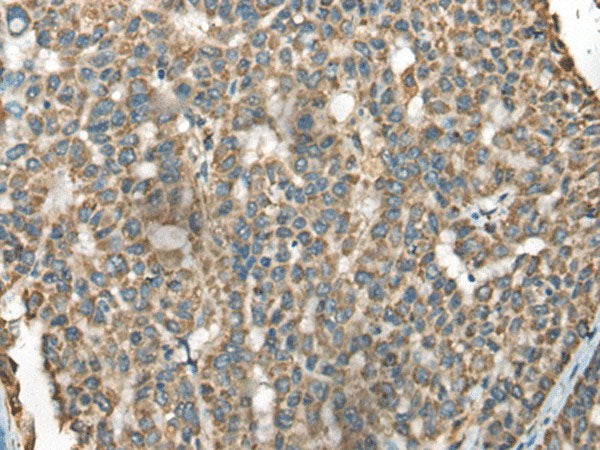 BLNK Polyclonal Antibody Reactivity Human