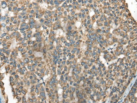 BLNK Polyclonal Antibody Reactivity Human