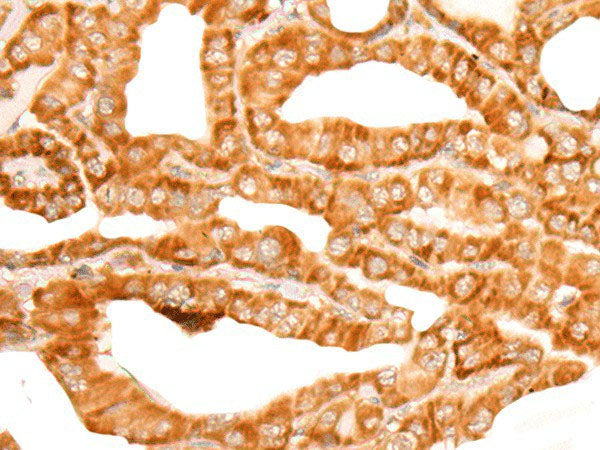 ZMYND10 Polyclonal Antibody