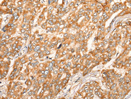 ZMYND10 Polyclonal Antibody