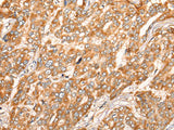 ZMYND10 Polyclonal Antibody