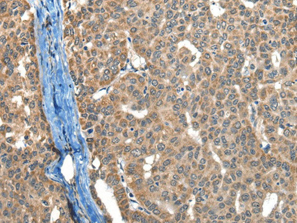 BOLA1 Polyclonal Antibody Reactivity Human