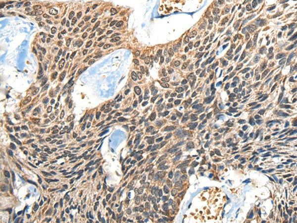BOLA1 Polyclonal Antibody Reactivity Human