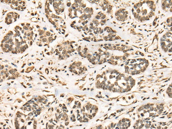 BRD7 Polyclonal Antibody