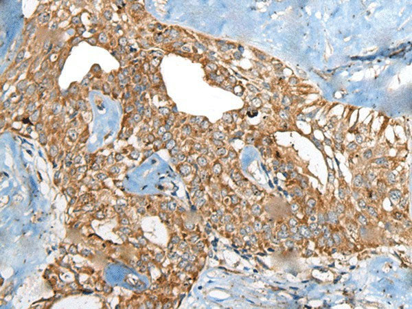 BRD9 Polyclonal Antibody Reactivity Human