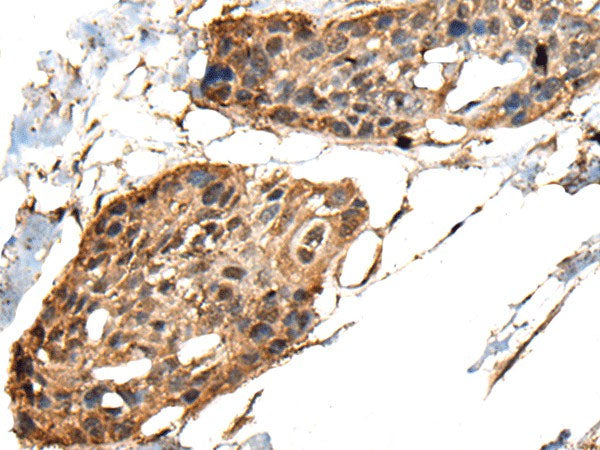 MCPH1 Polyclonal Antibody Reactivity Human
