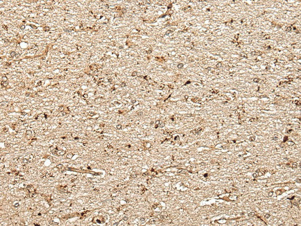 MCPH1 Polyclonal Antibody Reactivity Human