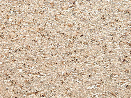 MCPH1 Polyclonal Antibody Reactivity Human