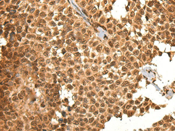 BRSK1 Polyclonal Antibody Reactivity Human