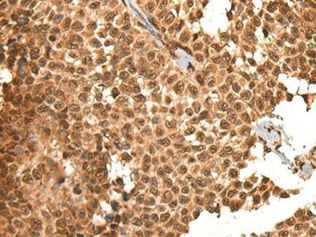 BRSK1 Polyclonal Antibody Reactivity Human