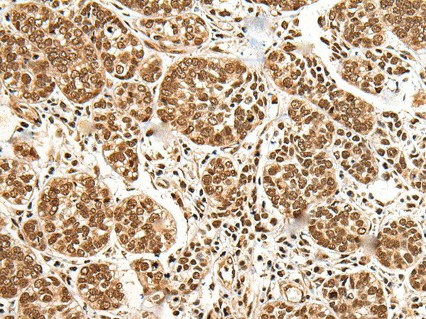 BRSK1 Polyclonal Antibody Reactivity Human