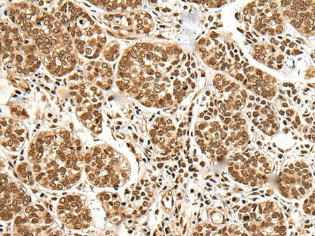 BRSK1 Polyclonal Antibody Reactivity Human