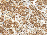 BRSK1 Polyclonal Antibody Reactivity Human