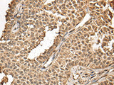 BUD31 Polyclonal Antibody Reactivity Human