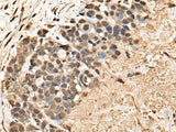 BUD31 Polyclonal Antibody Reactivity Human