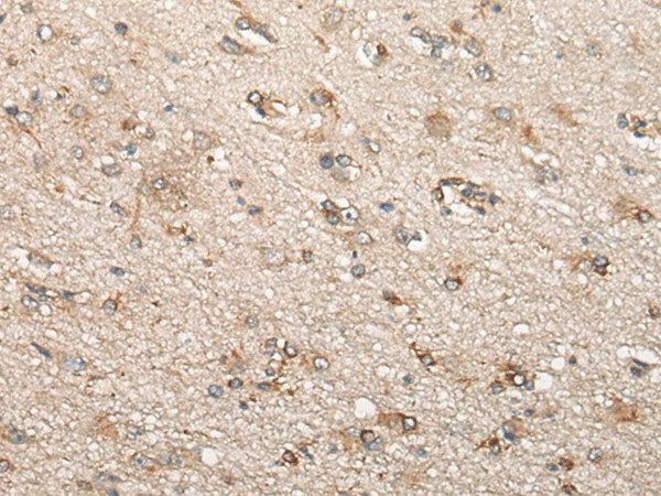BCHE Polyclonal Antibody Reactivity Human