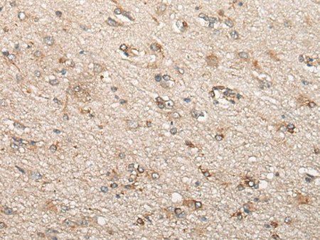 BCHE Polyclonal Antibody Reactivity Human