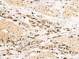 LRIF1 Polyclonal Antibody Reactivity Human