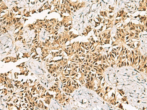 LRIF1 Polyclonal Antibody Reactivity Human