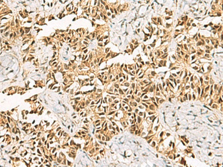 LRIF1 Polyclonal Antibody Reactivity Human